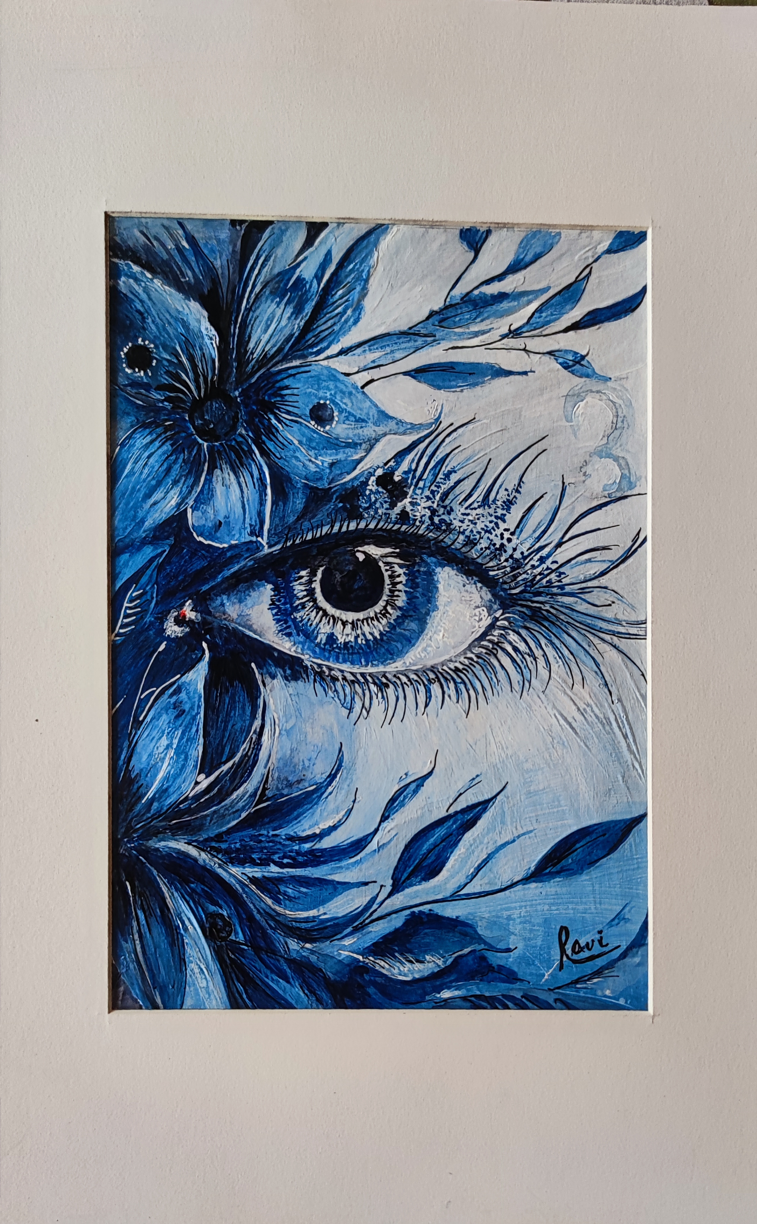 Eye